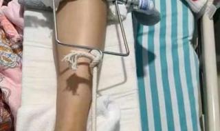 女子上瑜伽课被老师压断大腿